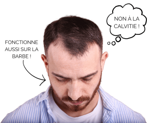 comment éviter la calvitie à dijon